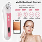 hd-camera-blackhead-extractor-closeup