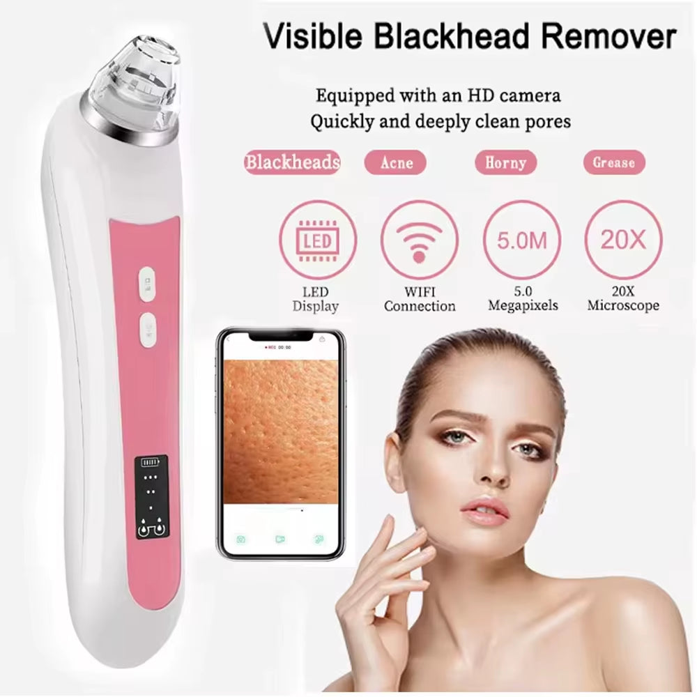 hd-camera-blackhead-extractor-closeup